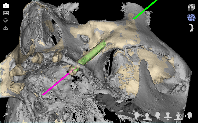 Fig. 25