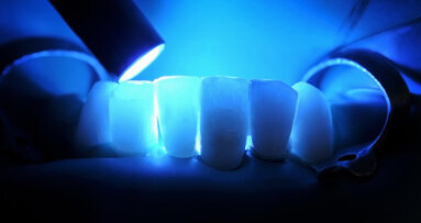 Researchers use AI to predict dental composite performance