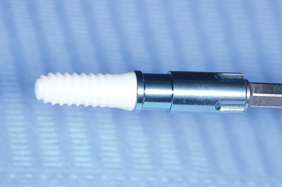 Fig. 6 : Insertion de l’implant.