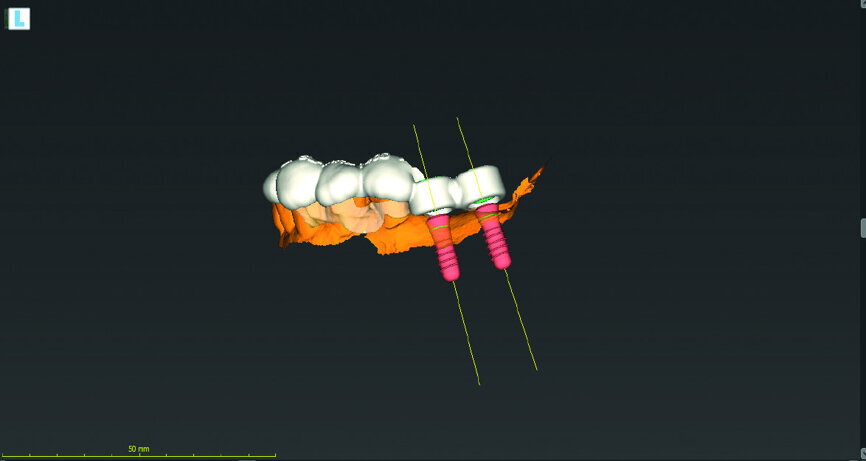 Fig. 8