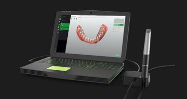 Virtuo Vivo™ Intraoral Scanner: l’inizio di una nuova era digitale