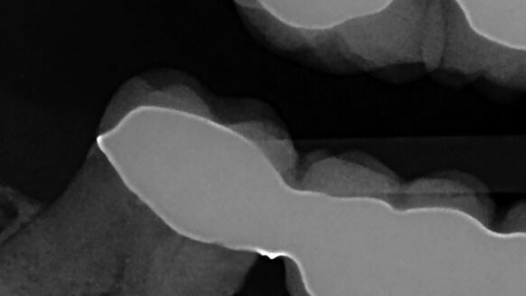 Bioactive materials: A new approach to dental care