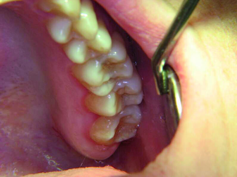 Figure 10c