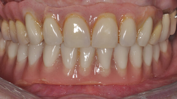 Reconstructive Periodontal Plastic Surgery course held in Lahore
