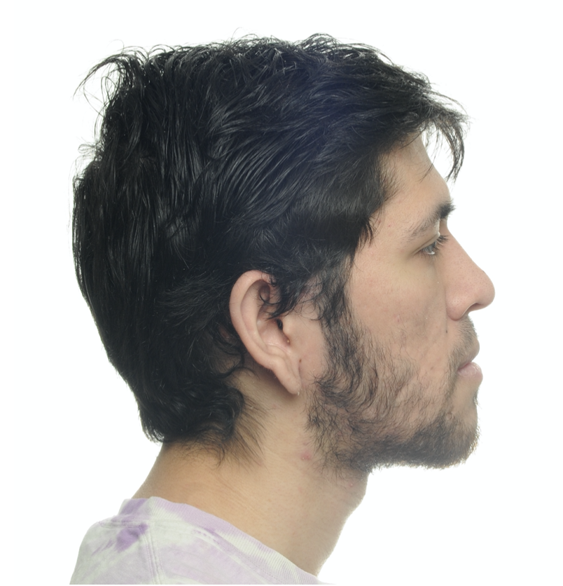 Fig. 48