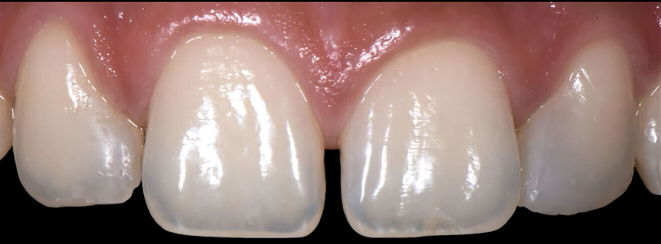 Fig. 2b