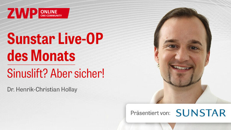 1 CME-Punkt: Sunstar Live-OP „Sinuslift? Aber sicher!“ im Archiv