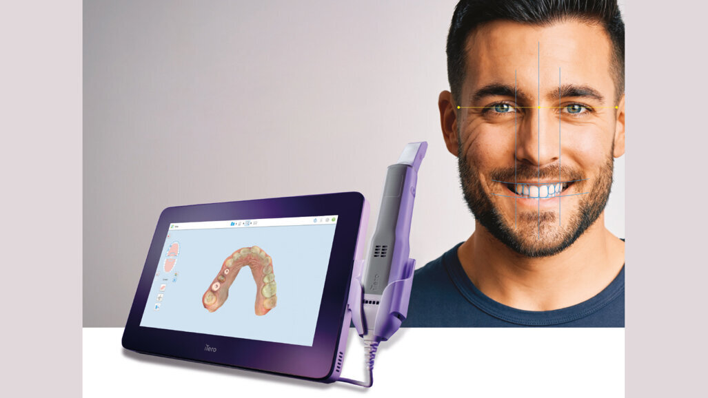 Align Technology continua  a rivoluzionare la pianificazione  dei trattamenti odontoiatrici  e restaurativi con le innovazioni  del sistema Invisalign