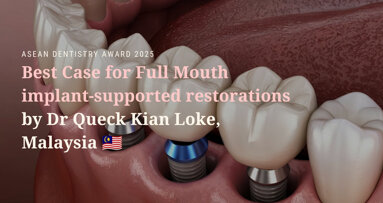 ASEAN Dentistry Award 2025 winners showcase: Full-mouth implant-supported restorations