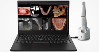 DEXIS Intraoralscanner jetzt mit offener und KI-unterstützter Bildgebungssoftware
