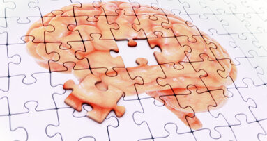 Study confirms gingival recession increases risk of Alzheimer’s disease