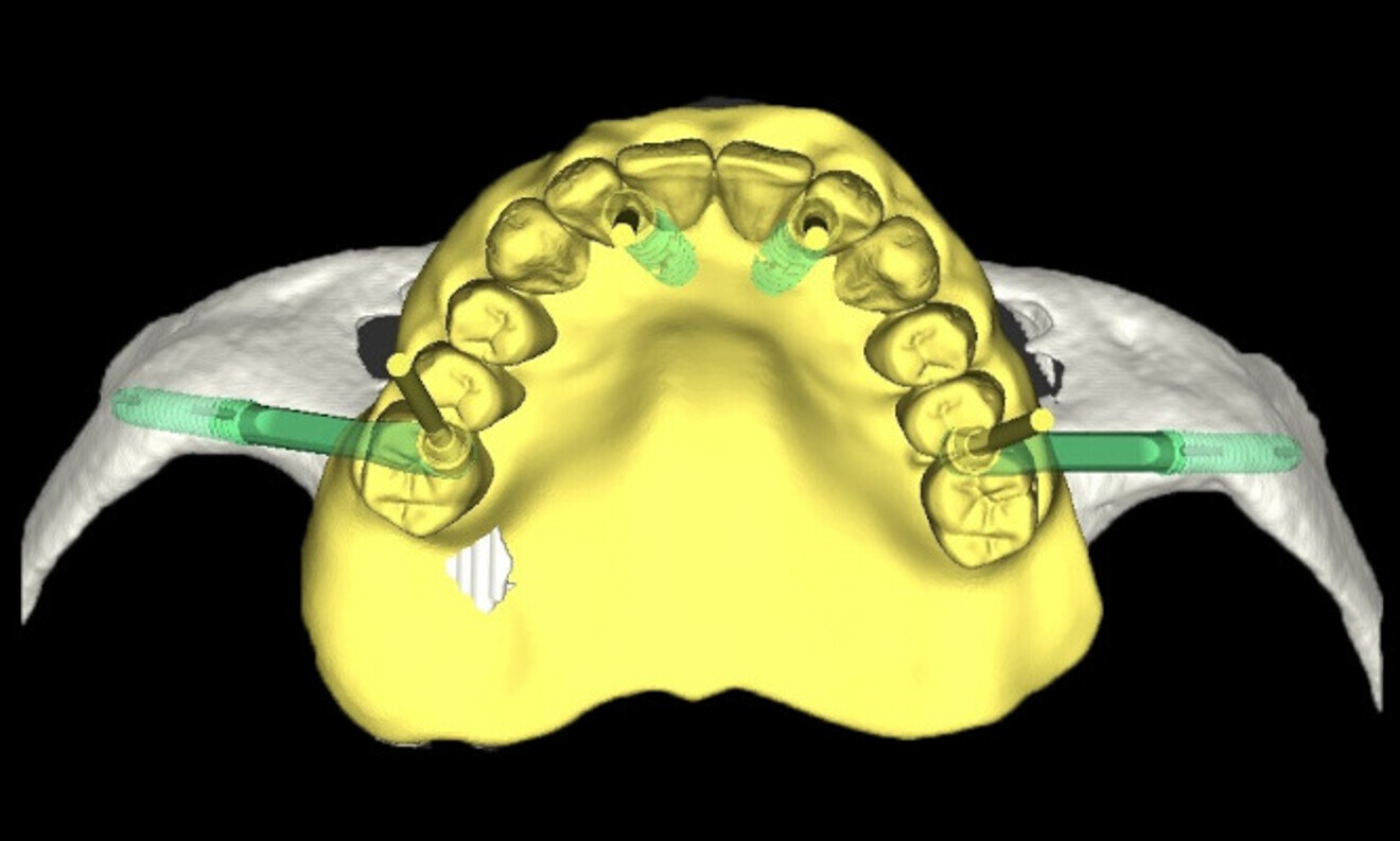 Fig. 4
