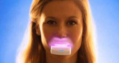 Intra-orale lichttherapie kan duur orthobehandeling verkorten