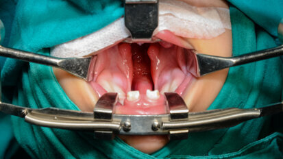 USC researchers seek to understand craniofacial abnormalities