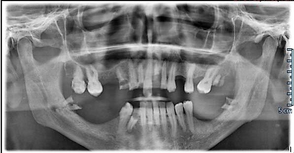 Fig. 3.