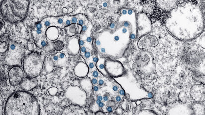 Henry Schein announces further efforts to address the COVID-19 pandemic