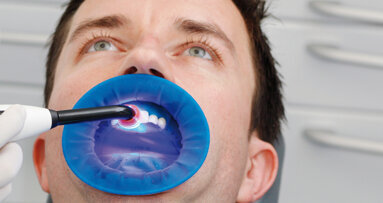 Interview with Dr. Richard Price: The importance of a high-quality curing light
