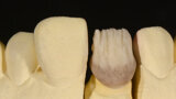 Figura 4