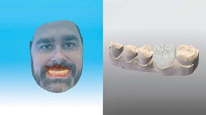 Dental Wings announces release of major software updates
