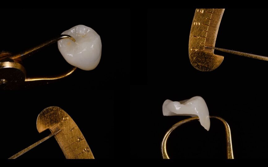 Fig. 10