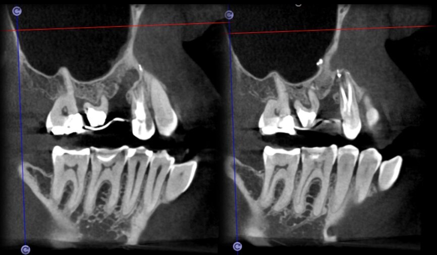 Fig. 24