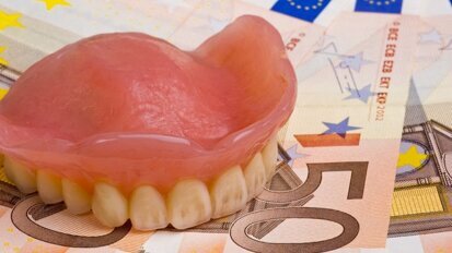 Allergiker tragen zusätzliche Kosten für Zahnersatz