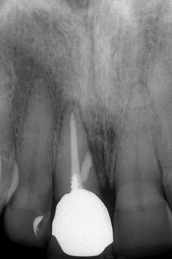 Fig. 2e