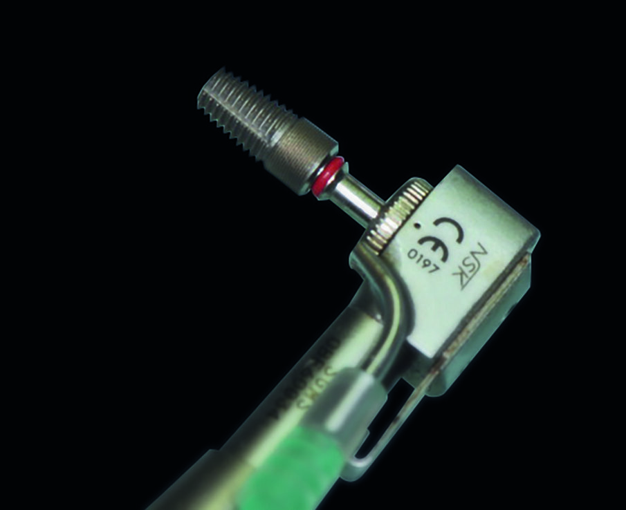 Fig. 12