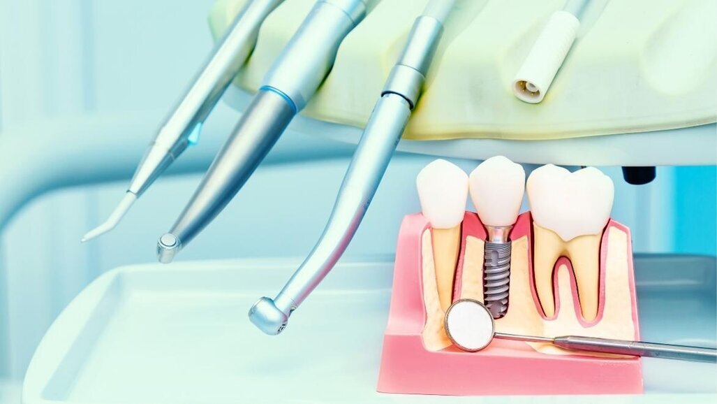 “Wij verkopen geen implantaten” - heroverweging nodig