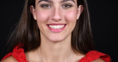 Addressing smile aesthetics with digital orthodontic planning and treatment: A case report