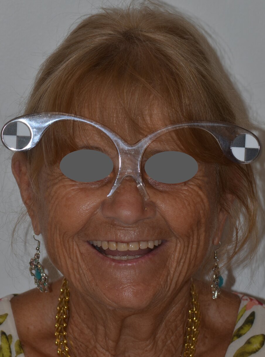 Fig. 1b - La fotografia fa la differenza nel progetto digitale, il viso deve essere centrato sulla linea mediana per consentire la visualizzazione corretta dell’emiarcata destra e sinistra. 