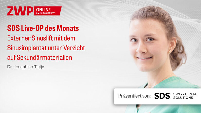 1 CME-Punkt: SDS Live-OP mit Dr. Josephine Tietje im Archiv abrufbar