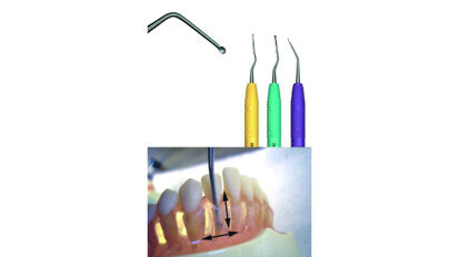 Innovative Kürettenserie