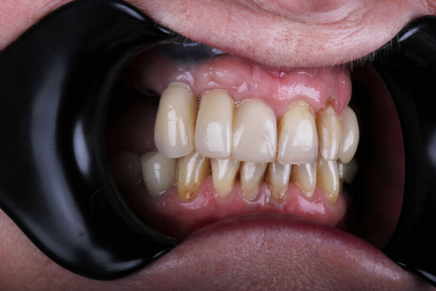 Fig. 13
