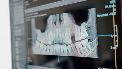 Predictable aesthetic success with a digital workflow