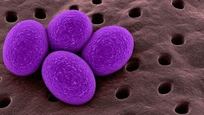 I microbi minacciano la salute dei pazienti ortodontici
