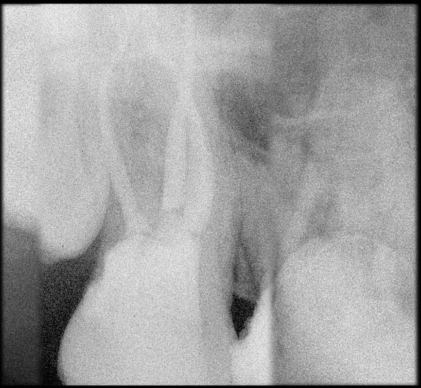 Fig. 19