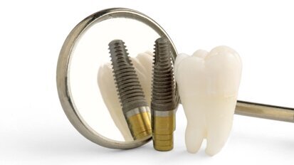 Seminar zu Periimplantitis