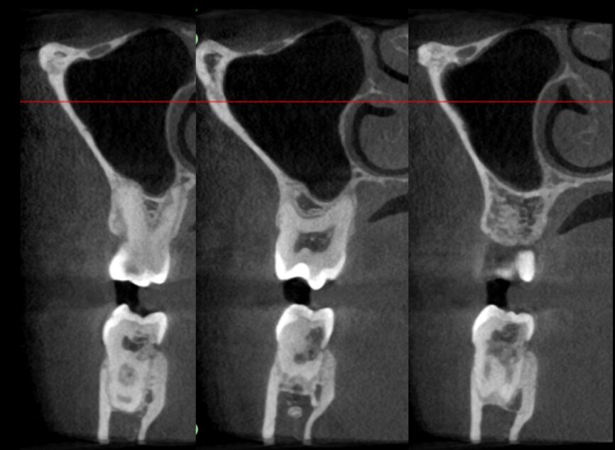 Fig. 21