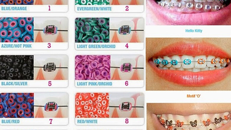 La Ortodoncia: ¿salud o moda?
