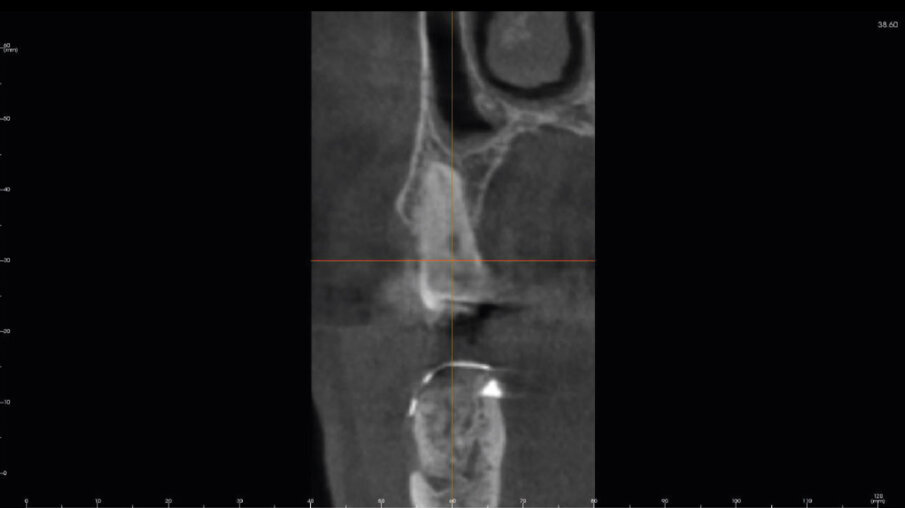 Fig. 11