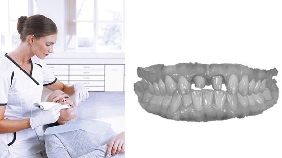 3Shape launches world’s first upgradable entry-level intra-oral scanner