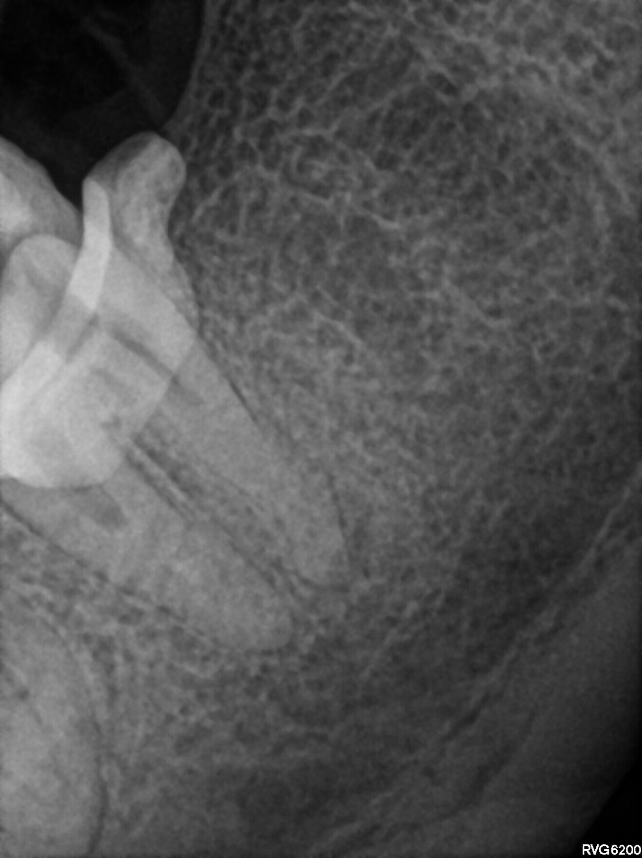 Fig. 17
