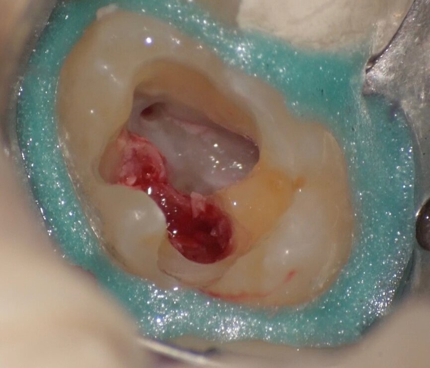 Fig. 16