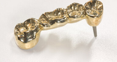 Gold für Dentallegierungen weniger gefragt