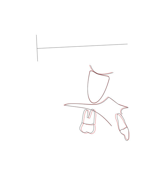 Fig. 47