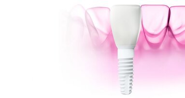 Biotech Dental ajoute l’implant céramique ZERAMEX XT à son catalogue