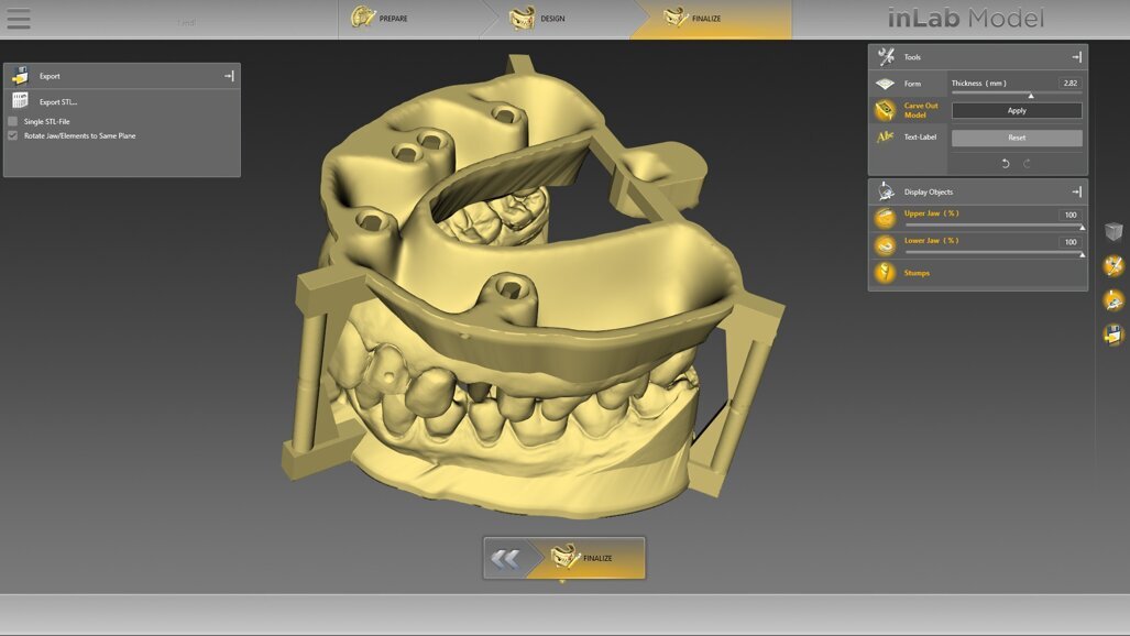 Nuove indicazioni, più funzioni: si aggiorna il software inLab 18.0