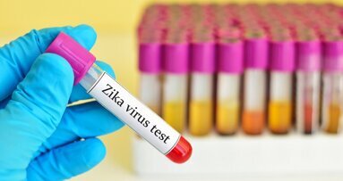 Researchers test new means of Zika diagnosis