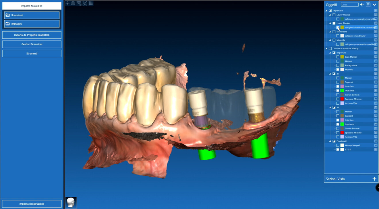 Fig. 4b